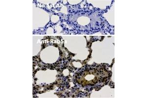 Immunohistochemistry (IHC) image for anti-RAB5A, Member RAS Oncogene Family (RAB5A) (C-Term) antibody (ABIN1439994)