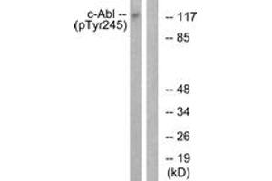 Western blot analysis of extracts from K562 cells treated with Insulin 0.