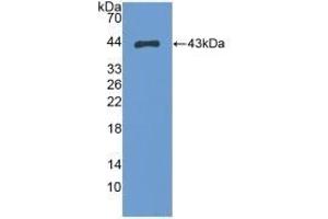 Detection of Recombinant S100A2, Human using Polyclonal Antibody to S100 Calcium Binding Protein A2 (S100A2)