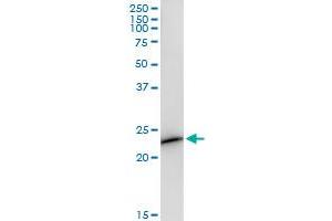 Immunoprecipitation of DCAKD transfected lysate using anti-DCAKD MaxPab rabbit polyclonal antibody and Protein A Magnetic Bead , and immunoblotted with DCAKD purified MaxPab mouse polyclonal antibody (B01P) .