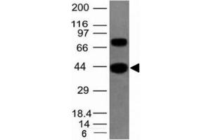 anti-Pan Muscle Actin antibody
