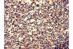 Immunohistochemistry analysis of human tonsil tissue using ABIN7156038 at dilution of 1:100 (IgD anticorps  (AA 1-240))