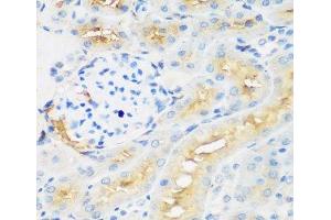 Immunohistochemistry of paraffin-embedded Rat kidney using PROCR Polyclonal Antibody at dilution of 1:200 (40x lens). (PROCR anticorps)
