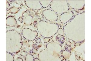 Immunohistochemistry of paraffin-embedded human thyroid tissue using ABIN7175755 at dilution of 1:100 (WDR47 anticorps  (AA 350-600))