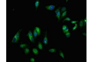 Immunofluorescent analysis of Hela cells using ABIN7151864 at dilution of 1:100 and Alexa Fluor 488-congugated AffiniPure Goat Anti-Rabbit IgG(H+L)
