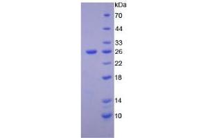 SDS-PAGE analysis of Human PTK7 Protein. (PTK7 Protéine)