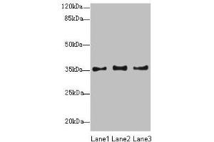 Western blot All lanes: NUP35 antibody at 12 μg/mL Lane 1: Jurkat whole cell lysate Lane 2: A431 whole cell lysate Lane 3: HepG2 whole cell lysate Secondary Goat polyclonal to rabbit IgG at 1/10000 dilution Predicted band size: 35, 34, 22 kDa Observed band size: 35 kDa (NUP35 anticorps  (AA 6-305))