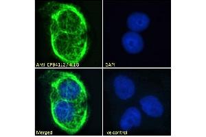 ABIN238594 Immunofluorescence analysis of paraformaldehyde fixed A431 cells, permeabilized with 0. (EPB41L2 anticorps  (Internal Region))