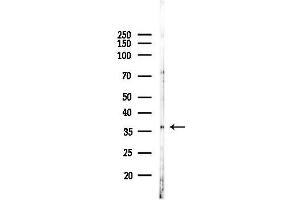 Western blot analysis of lysates from K562 cells(UV 30 min treatment), using IKB alpha Antibody at 1/1000 dilution.