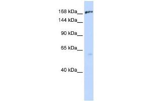 ABCC1 antibody used at 1 ug/ml to detect target protein. (ABCC1 anticorps)