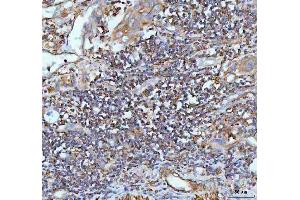 IHC analysis of IL22 using anti-IL22 antibody (ABIN5518929).