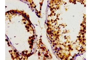 Immunohistochemistry of paraffin-embedded human testis tissue using ABIN7149710 at dilution of 1:100 (DHPS anticorps  (AA 1-94))
