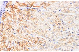 Immunohistochemistry of paraffin-embedded Human liver using IFNAR1 Polyclonl Antibody at dilution of 1:200. (IFNAR1 anticorps)