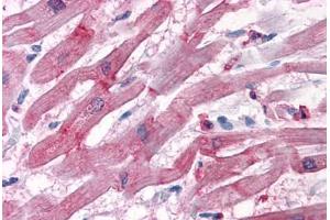 Human Heart: Formalin-Fixed, Paraffin-Embedded (FFPE) (BAG3 anticorps  (AA 563-575))