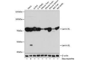 Western blot analysis of extracts of various cell lines, using Lamin B1 Rabbit mAb (ABIN7268180) at 1:1000 dilution.
