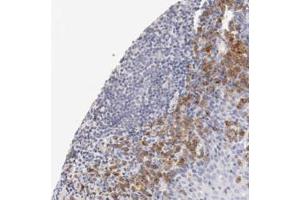 Immunohistochemical staining (Formalin-fixed paraffin-embedded sections) of human tonsil with LAX1 polyclonal antibody  shows moderate cytoplasmic positivity in lymphoid cells outside reaction center. (LAX1 anticorps)