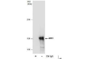 IP Image Immunoprecipitation of NRF2 protein from HepG2 whole cell extracts using 5 μg of NRF2 antibody [N2C2], Internal, Western blot analysis was performed using NRF2 antibody [N2C2], Internal, EasyBlot anti-Rabbit IgG  was used as a secondary reagent.