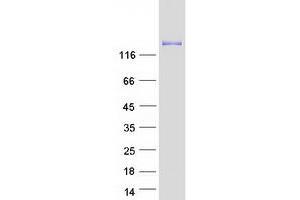 Validation with Western Blot