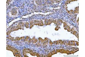IHC analysis of GLIS1 using anti-GLIS1 antibody (ABIN7599501).