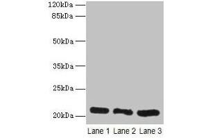 Western blot All lanes: GM2A antibody at 10 μg/mL Lane 1: Rat liver tissue Lane 2: Mouse stomach tissue Lane 3: Mouse small intestine tissue Secondary Goat polyclonal to rabbit IgG at 1/10000 dilution Predicted band size: 21 kDa Observed band size: 21 kDa (GM2A anticorps  (AA 32-193))