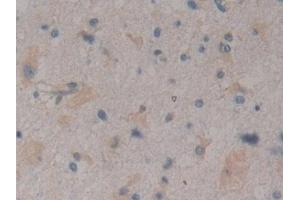 Detection of RNPEP in Human Glioma Tissue using Polyclonal Antibody to Aminopeptidase B (RNPEP)
