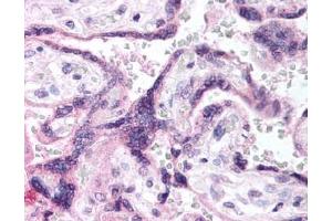 Image no. 1 for anti-Epidermal Growth Factor Receptor (EGFR) (AA 1189-1199), (pTyr1197) antibody (ABIN401341) (EGFR anticorps  (pTyr1197))