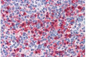 Human Spleen: Formalin-Fixed, Paraffin-Embedded (FFPE)