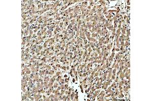IHC analysis of KAT1/HAT1 using anti-KAT1/HAT1 antibody (ABIN7603224). (HAT1 anticorps  (N-Term))