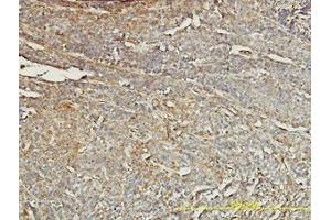 Image no. 4 for anti-Tropomyosin 4 (TPM4) (AA 1-249) antibody (ABIN598984) (Tropomyosin 4 anticorps  (AA 1-249))