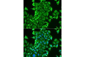 Immunofluorescence analysis of HeLa cells using CARS antibody (ABIN6129260, ABIN6137946, ABIN6137948 and ABIN6222203).