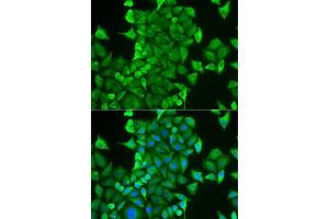 Immunofluorescence analysis of HeLa cells using CARS antibody (ABIN6129260, ABIN6137946, ABIN6137948 and ABIN6222203). (CARS anticorps  (AA 469-748))