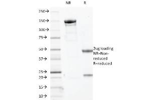 SDS-PAGE Analysis Purified p63 Mouse Monoclonal Antibody (TP63/2427). (p63 anticorps)