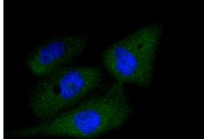 Immunofluorescence analysis of PC-3M cells using CASP3 antibody (ABIN4903137). (Caspase 3 anticorps)