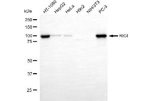 Western blotting analysis using RIGI antibody (ABIN7800966).