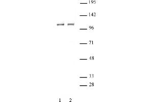 STAT2 antibody (pAb) tested by Western blot. (STAT2 anticorps  (C-Term))