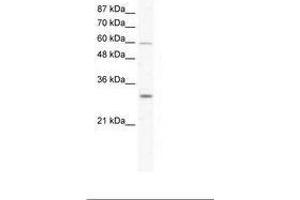 Image no. 1 for anti-DEAD (Asp-Glu-Ala-Asp) Box Polypeptide 31 (DDX31) (AA 140-189) antibody (ABIN203216) (DDX31 anticorps  (AA 140-189))