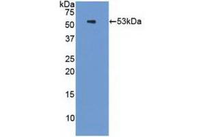 Western blot analysis of recombinant Human PSMC3. (PSMC3 anticorps  (AA 2-439))
