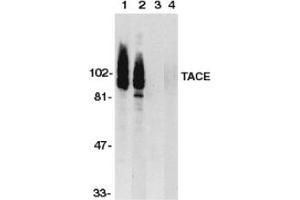 Image no. 1 for anti-ADAM Metallopeptidase Domain 17 (ADAM17) (C-Term) antibody (ABIN201454) (ADAM17 anticorps  (C-Term))
