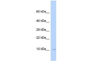 WB Suggested Anti-SUMO3 Antibody Titration: 0. (SUMO3 anticorps  (Middle Region))