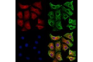 ABIN6260031 and ABIN6273193 staining Hela cells by IF/ICC. (ARHGDIB anticorps  (N-Term))