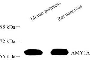 Western blot analysis of AMY1A (ABIN7075503) at dilution of 1: 500 (Salivary Amylase alpha anticorps)