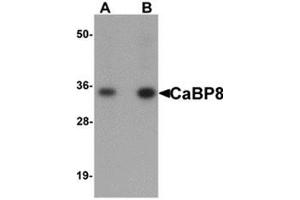 Western blot analysis of CaBP8 in 3T3 cell lysate with CaBP8 antibody at (A) 1 and (B) 2 μg/ml. (Calneuron 1 anticorps  (N-Term))
