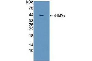 Detection of Recombinant GNb2, Human using Polyclonal Antibody to G Protein Beta 2 (GNb2)