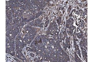 IHC analysis of NSF using anti-NSF antibody (ABIN7601630).