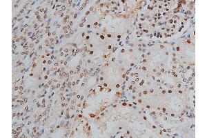 ABIN6268991 at 1/200 staining human kidney tissue sections by IHC-P. (PPP1R12A anticorps  (pThr853))