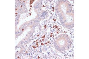 Immunohistochemistry of paraffin-embedded human colon using CD82 antibody (ABIN6131855, ABIN6138233, ABIN6138234 and ABIN6218884) at dilution of 1:100 (40x lens). (CD82 anticorps  (C-Term))