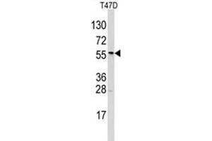 Image no. 1 for anti-Aldehyde Dehydrogenase 6 Family, Member A1 (ALDH6A1) (N-Term) antibody (ABIN356978) (ALDH6A1 anticorps  (N-Term))