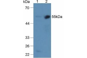 Figure. (alpha 2 Antiplasmin anticorps  (AA 340-491))