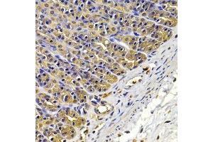 Immunohistochemistry of paraffin-embedded rat stomach using FSCN1 antibody. (Fascin anticorps  (AA 394-493))