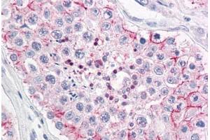 Human Testis: Formalin-Fixed, Paraffin-Embedded (FFPE)